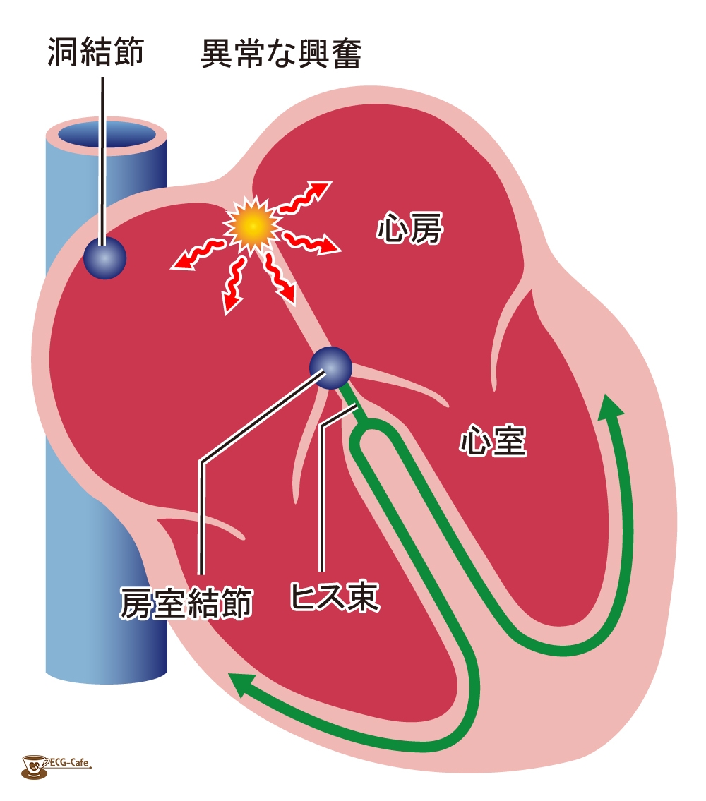 期 外 収縮 デパス 効果