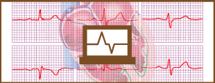 心電図個別指導のイメージ